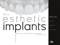 Esthetic implants. How to think about complex cases in anterior areas with a global approach to the patient' s smile