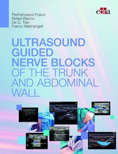 Ultrasound guided nerve blocks of the trunk and abdominal wall