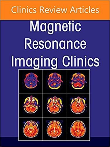 MR Imaging of Head and Neck Cancer, An Issue of Magnetic Resonance Imaging Clinics of North America