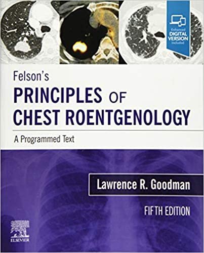 Felson's Principles of Chest Roentgenology. A Programmed Text