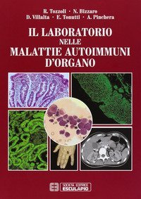 Il laboratorio nelle malattie reumatiche autoimmuni
