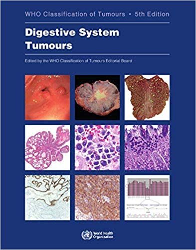 Digestive System Tumours  5°th Edition