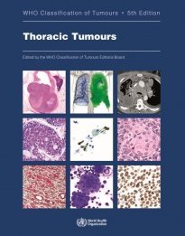 Who Classification of Tumors: Thoracic Tumours