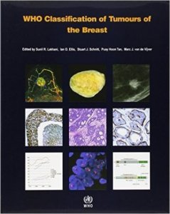WHO CLASSIFICATION OF TUMOURS OF THE BREAST