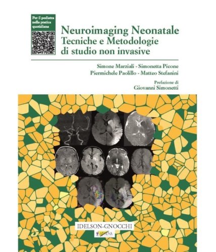Neuroimaging Neonatale Tecniche e Metodologie di studio non invasive