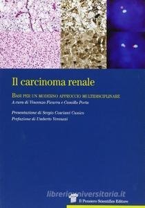 Il carcinoma renale