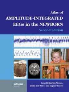 An Atlas of Amplitude-Integrated EEGs in the Newborn