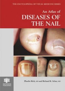 An Atlas of Diseases of the Nail