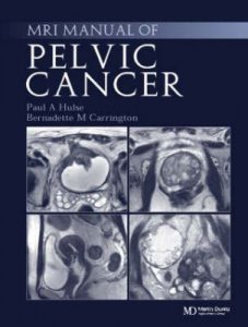 Handbook of Mri Staging of Pelvic Cancer
