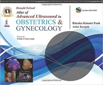 Donald School Atlas of Advanced Ultrasound in Obstetrics and Gynecology