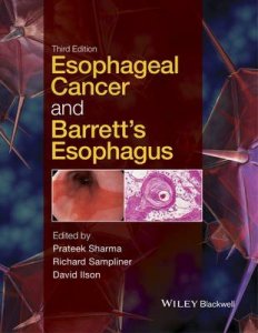 Esophageal Cancer and Barrett's Esophagus