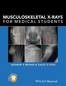 Musculoskeletal X-Rays for Medical Students