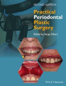 Practical Periodontal Plastic Surgery