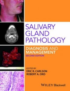 Salivary Gland Pathology Diagnosis and Management