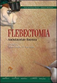 Flebectomia ambulatoriale estetica