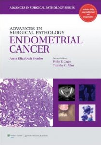 Endometrial cancer 