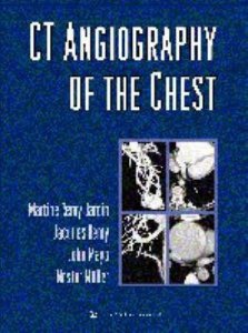 CT Angiography of the Chest