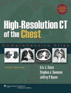 High-resolution CT of the Chest