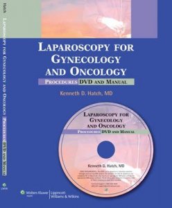 Laparoscopy for Gynecology and Oncology