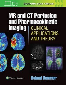 MR and CT Perfusion and Pharmacokinetic Imaging: Clinical Applications and Theory