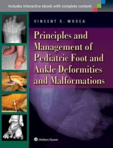 Principles and Management of Pediatric Foot and Ankle Deformities and Malformations