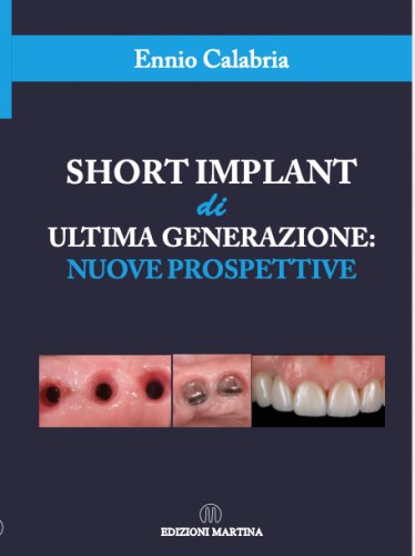 Short implant di ultima generazione: nuove prospettive