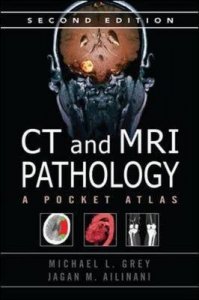 CT & MRI Pathology: a Pocket Atlas