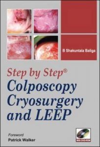 Step-by-step Colposcopy, Cryosurgery, and LEEP
