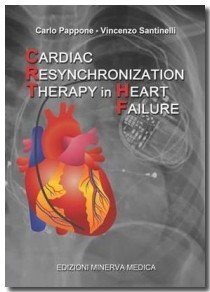 Cardiac resynchronization therapy in heart failure