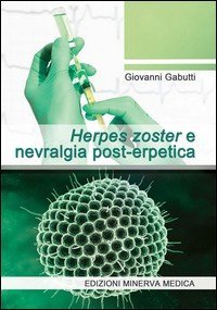 Herpes zoster e nevralgia post-erpetica