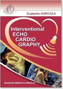 Interventional Echocardiography