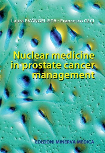Nuclear medicine in prostate cancer management