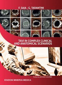TAVI in complex clinical and anatomical scenarios