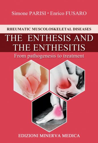 The enthesis and the enthesitis. From pathogenesis to treatment