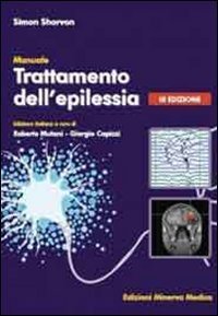 Trattamento dell'epilessia