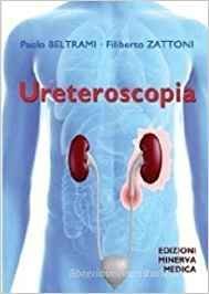Ureteroscopia