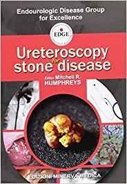 Ureteroscopy for stone disease
