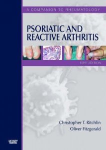 Psoriatic and Reactive Arthritis