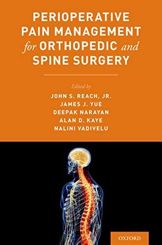 Perioperative Pain Management for Orthopaedic and Spine Surgery