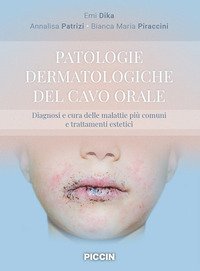 Patologie dermatologiche del cavo orale. Diagnosi e cura delle malattie più comuni e trattamenti estetici