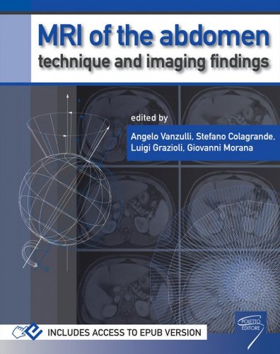 MRI of the abdomen: technique and imaging findings