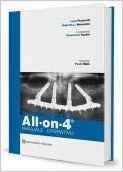 All-on-4. Manuale operativo