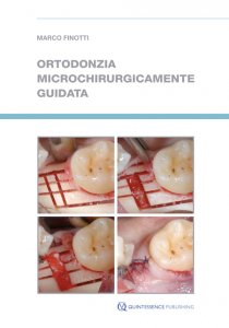 Ortodonzia microchirurgicamente guidata