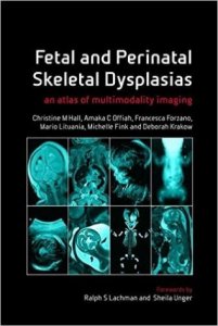 Fetal and Perinatal  Skeletal Dysplasias