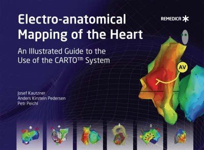 Electro-anatomical Mapping of the Heart
