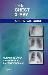 The Chest X-Ray, a Survival Guide