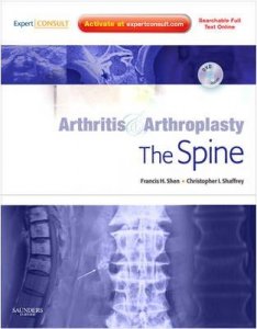 Arthritis and Arthroplasty: The Spine