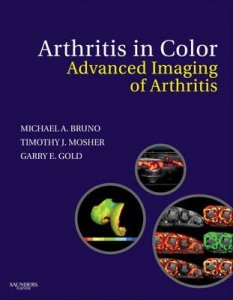 Arthritis in Color