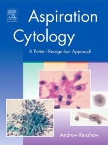 Aspiration Cytology