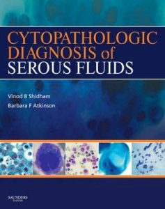 Cytopathologic Diagnosis of Serous Fluids